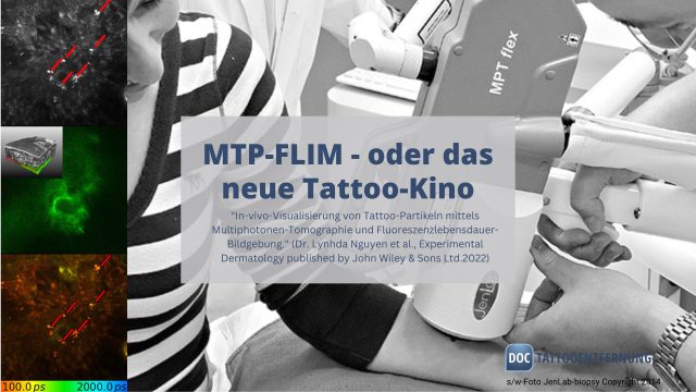 MTP-FLIM – oder das neue Tattoo-Kino