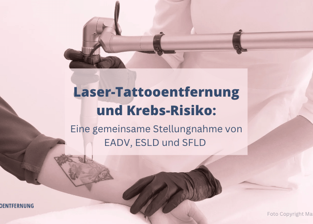 Laser-Tattooentfernung und Krebs-Risiko
