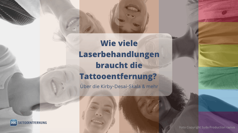 Wie viele Laserbehandlungen braucht die Tattooentfernung? Kirby-Desai-Skala & mehr