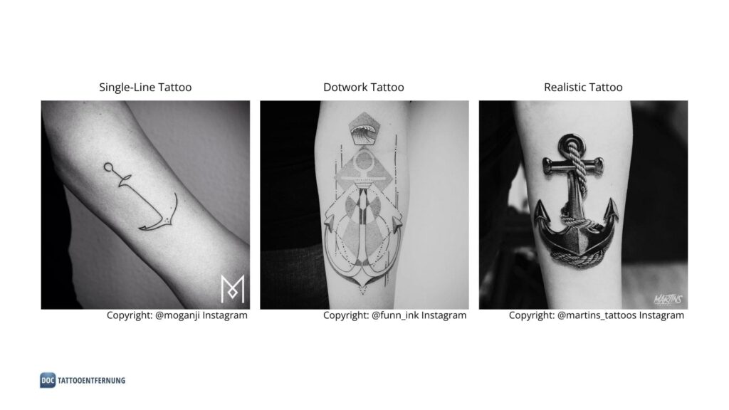 Anker-Tattoo verschiedene Stil-Richtungen Copyright Doc Tattooentfernung 2024
