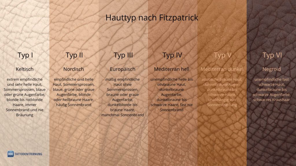 Hauttyp I-VI nach Fitzpatrick Tabelle Copyright Doc Tattooentfernung 2024