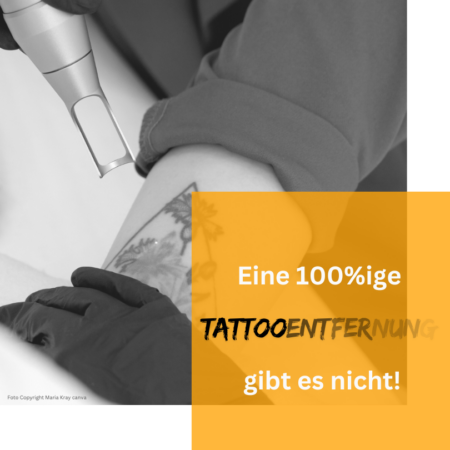 Keine-100-prozentige-Tattooentfernung-Copyright-Doc-Tattooentfernung-2026