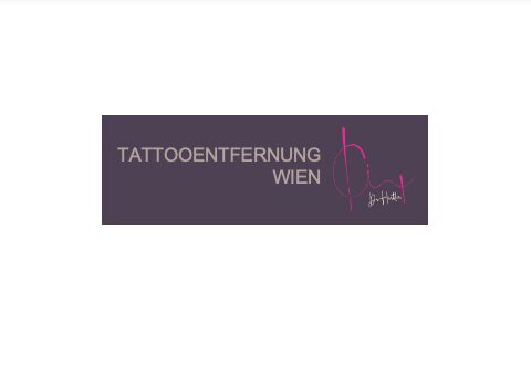 Tattooentfernung Wien