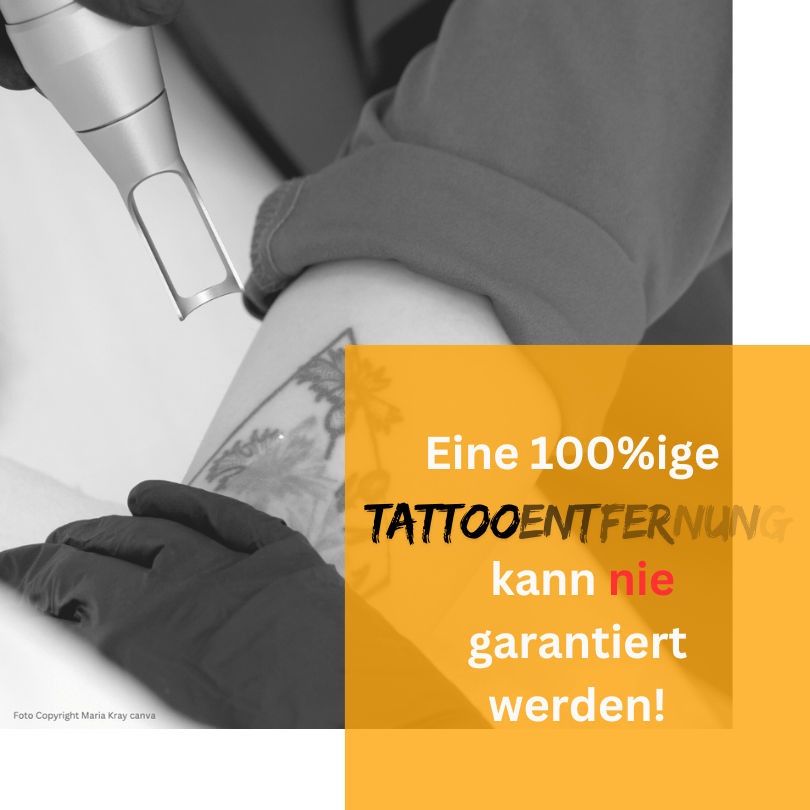 100 prozentige Tattooentfernung kann nie garantiert werden Copyright Doc Tattooentfernung 2024