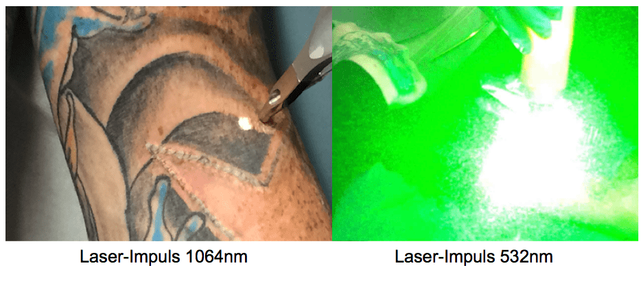Laserimpuls 1064nm und 532nm