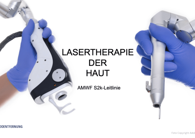 „Lasertherapie der Haut“ – die neue S2k-Leitlinie ist online