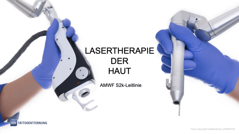 „Lasertherapie der Haut“ – die neue S2k-Leitlinie ist online