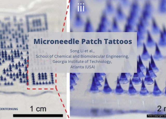 Microneedle Patch Tattoos erleichtern das medizinische, veterinärmedizinische und kosmetische Tätowieren