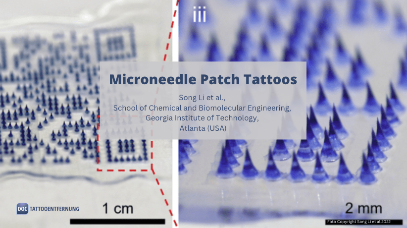 Microneedle Patch Tattoos erleichtern das medizinische, veterinärmedizinische und kosmetische Tätowieren
