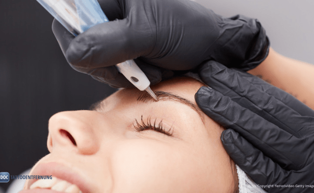 Permanent Make-up Entfernung mit Laser