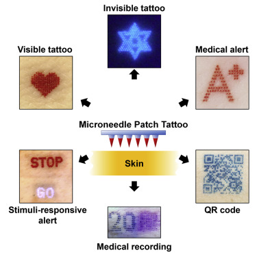Abb.: Microneedle-Patch-Tattoos, Song Li et al., DOI: 10.1016/j.isci.2022.105014  
