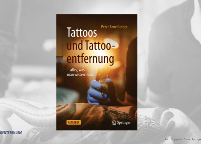 Tattoos und Tattooentfernung – alles was man wissen muss