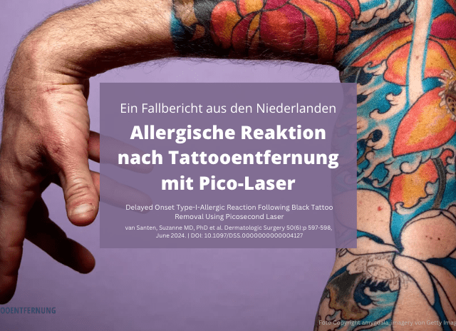 Allergische Reaktion nach Tattooentfernung mit Pico‑Laser