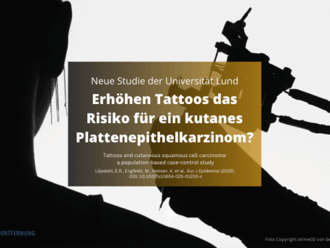 Erhöhen Tattoos das Risiko für ein kutanes Plattenepithelkarzinom Foto Copyright shime02 von Getty Images canva for Doc Tattooentfernung 2025