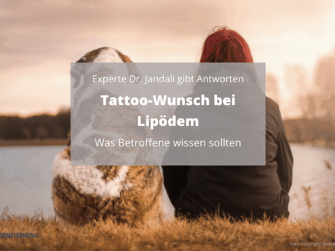 Tattoo-Wunsch bei Lipödem Foto Copyright Seaq68 von pixabay canva for Doc Tattooentfernung 2025