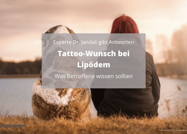 Tattoo-Wunsch bei Lipödem: Was Betroffene wissen sollten