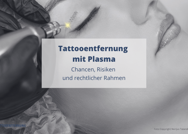 Tattooentfernung mit Plasma – Chancen, Risiken und rechtlicher Rahmen