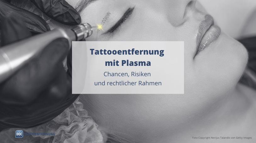 Tattooentfernung mit Plasma – Chancen, Risiken und rechtlicher Rahmen