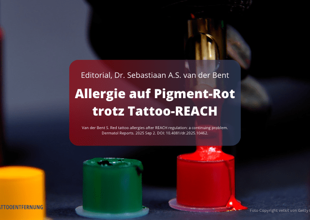 Allergie auf Pigment-Rot trotz Tattoo-REACH