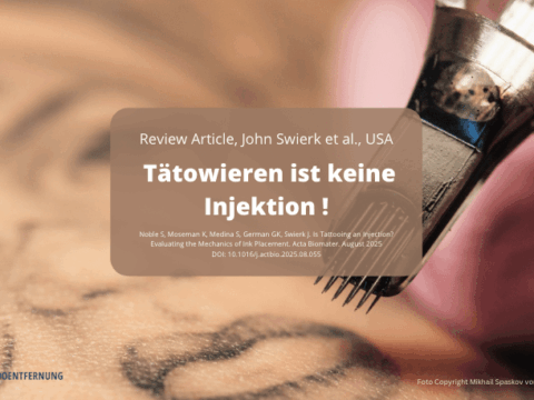 Tätowieren ist keine Injektion, J. Swierk Foto Copyright Mikhail Spaskov von Getty Images canva for Doc Tattooentfernung 2025