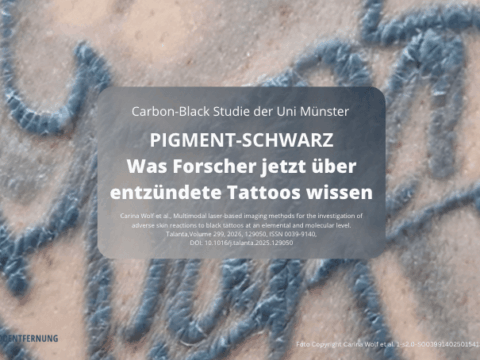 Pigment-schwarz - was Forscher jetzt über entzündete Tattoos wissen Foto Copyright Carina Wolf et al. 1-s2.0-S0039914025015413-gr1_lrg Uni Münster for Doc Tattooentfernung 2025