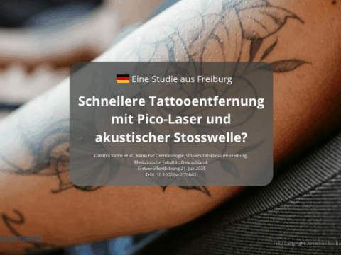 Schnellere Tattooentfernung mit Pico-Laser und akustischer Stosswelle Foto Copyright Jonathan Borba von Pexels canva 2025 for DocTattooentfernung