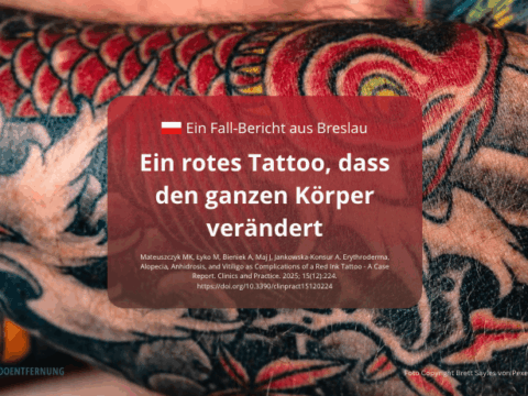Ein rotes Tattoo, dass den ganzen Körper verändert - Fall-Bericht aus Polen Foto Copyright Brett Sayles von Pexels canva - Symbolbild for Doc Tattooentfernung 2026