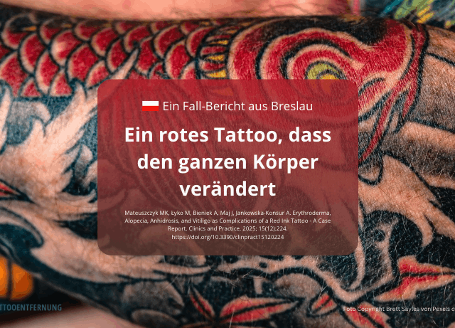 Ein rotes Tattoo, dass den ganzen Körper verändert – Fall-Bericht