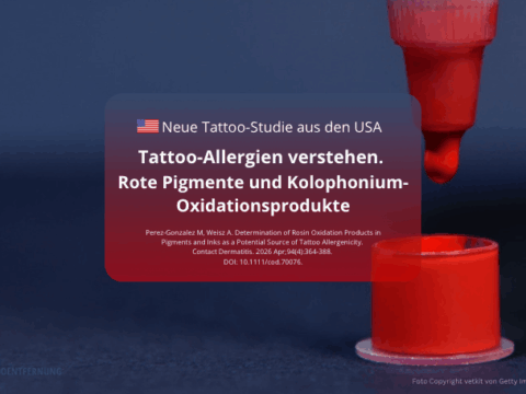 Tattoo-Allergien verstehen. Rote Pigmente und Kolophonium-Oxidationsprodukte Foto Copyright vetkit von Getty Images canva for Doc Tattooentfernung 2026