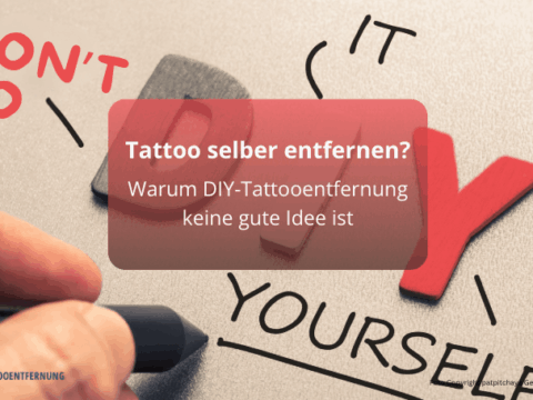 Tattoo selber entfernen - Warum DIY-Tattooentfernung keine gute Idee ist Foto Copyright patpitchaya Getty Images canva for Doc Tattooentfernung 2026