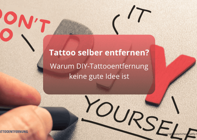 Tattoo selber entfernen? Warum DIY-Tattooentfernung keine gute Idee ist