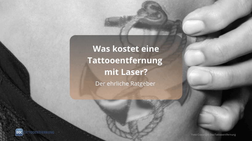 Was kostet eine Tattooentfernung mit Laser wirklich? Der ehrliche Ratgeber