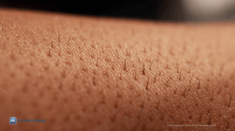 Paradoxe Haarstimmulation durch Laserbehandlung Foto Copyright tarkan36 von pixabay canva for Doc Tattooentfernung 2026
