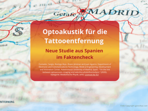 Optoakustik für die Tattooentfernung Foto Copyright goralikus von Getty Images canva for Doc Tattooentfernung 2026