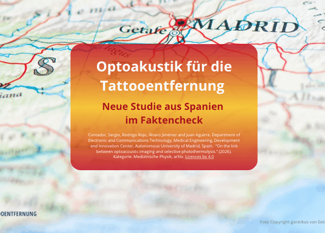Optoakustik für die Tattooentfernung: Neue Studie aus Madrid im Faktencheck