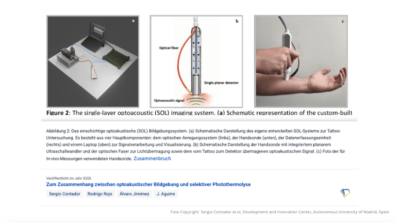 SOL Single-Layer Optoacoustic Foto Copyright Sergio Contador et al. Development and Innovation Center Autonomous University of Madrid Spain for DocTattooentfernung 2026