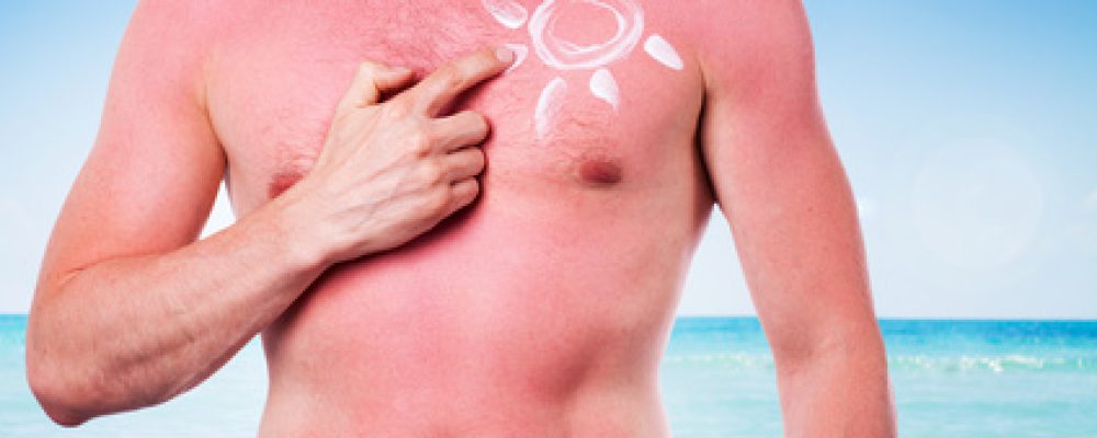 Fakten zum Thema Sonnenschutz für die Haut