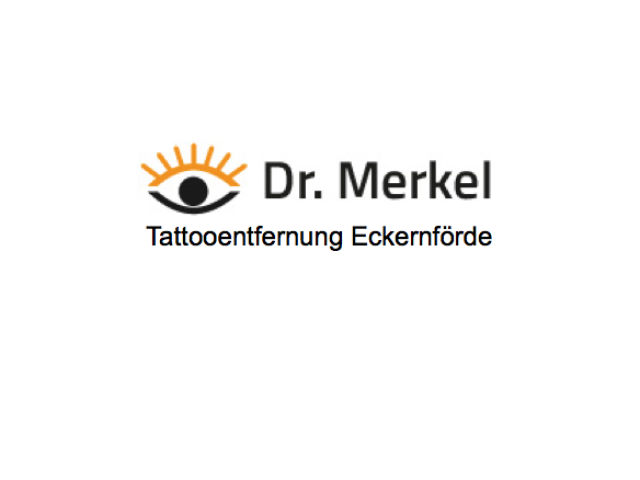 Tattooentfernung Eckernförde