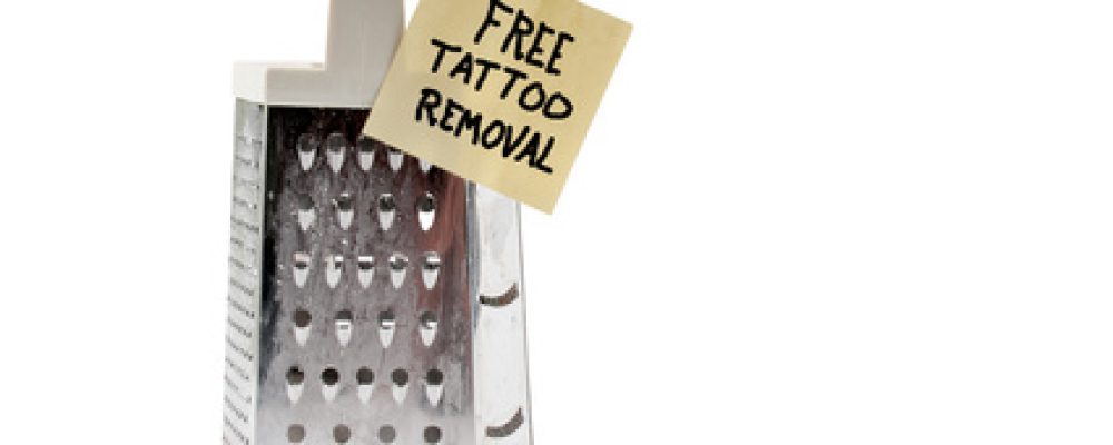 Tattooentfernung ohne Laser