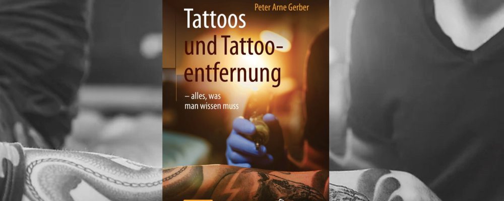 Tattoos und Tattooentfernung – alles was man wissen muss