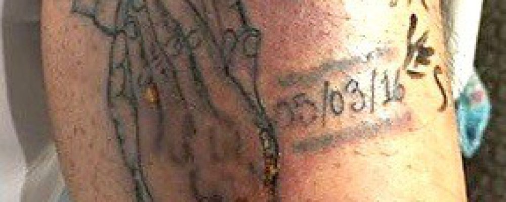 Tod durch Tattoo?