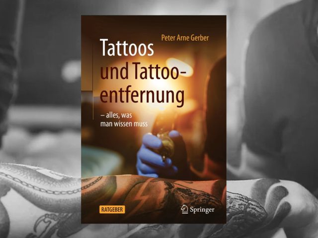 Tattoos und Tattooentfernung – alles was man wissen muss