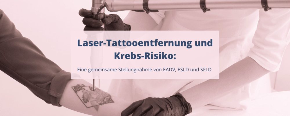 Laser-Tattooentfernung und Krebs-Risiko: Eine gemeinsame Stellungnahme dreier renommierter Derma-Fachgesellschaften.